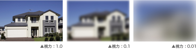 視力障害の見え方