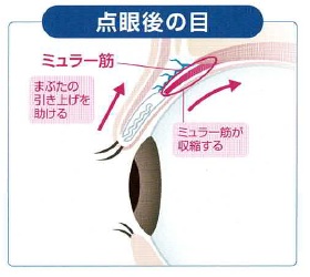 点眼後の目