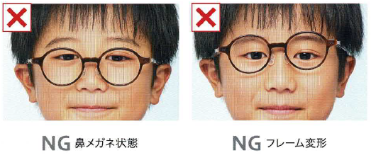 NG